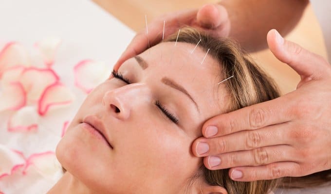 Acupuncture and Insomnia treatment