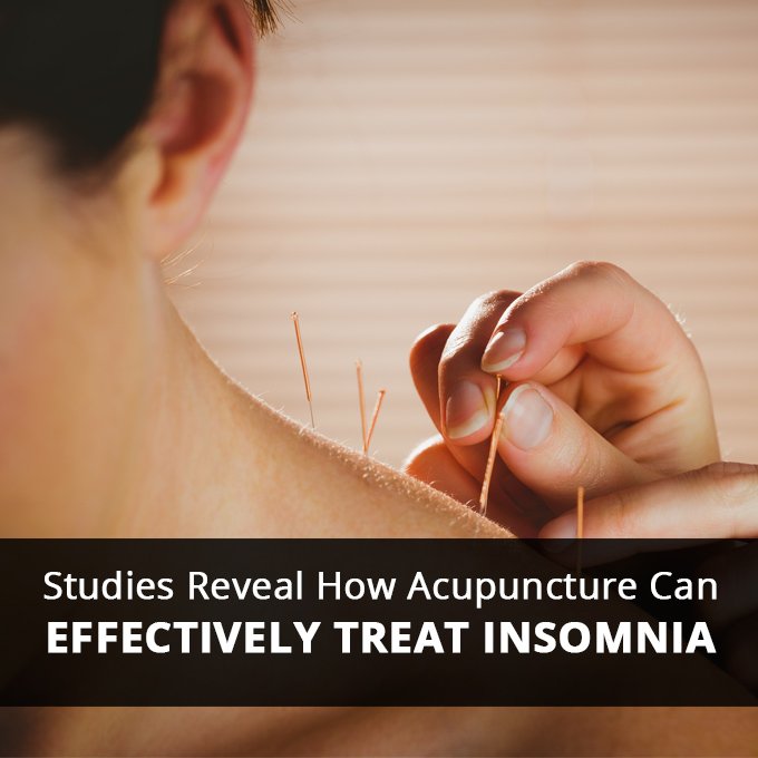 Studies Reveal How Acupuncture Can Effectively Treat Insomnia680x680 4