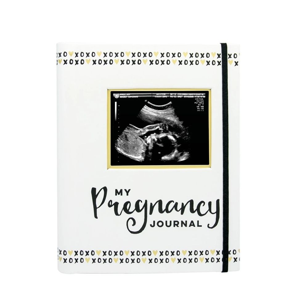 my pregnancy journal